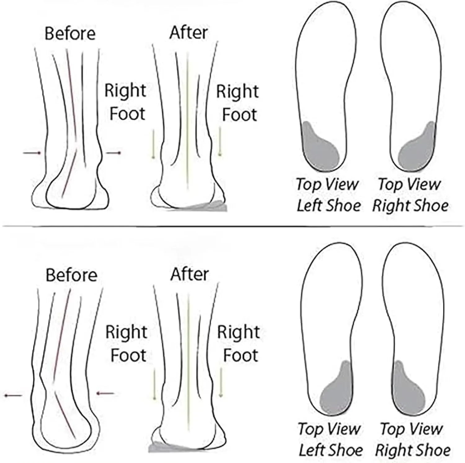 Women's Lightweight Soft Sole Mesh Comfort Orthopedic Shoes,Casual Breathable Soft Anti-Skid Sports Footwear