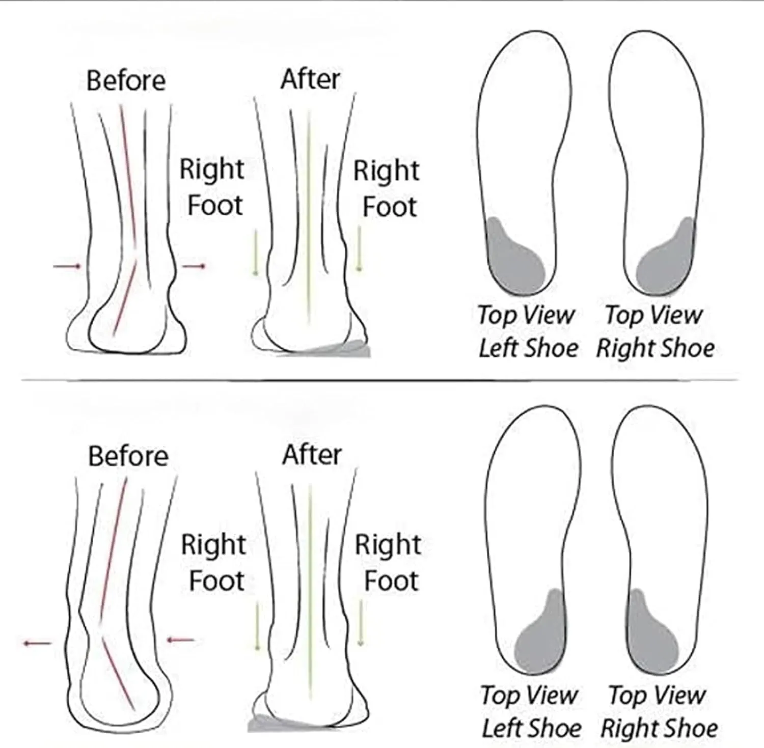 Women's Soft Sole Mesh Comfort Orthopedic Shoes, 2025 New Slip-on Walking Shoes with Arch Support